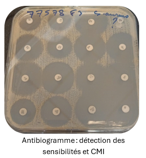 ANTIBIOGRAMME 2