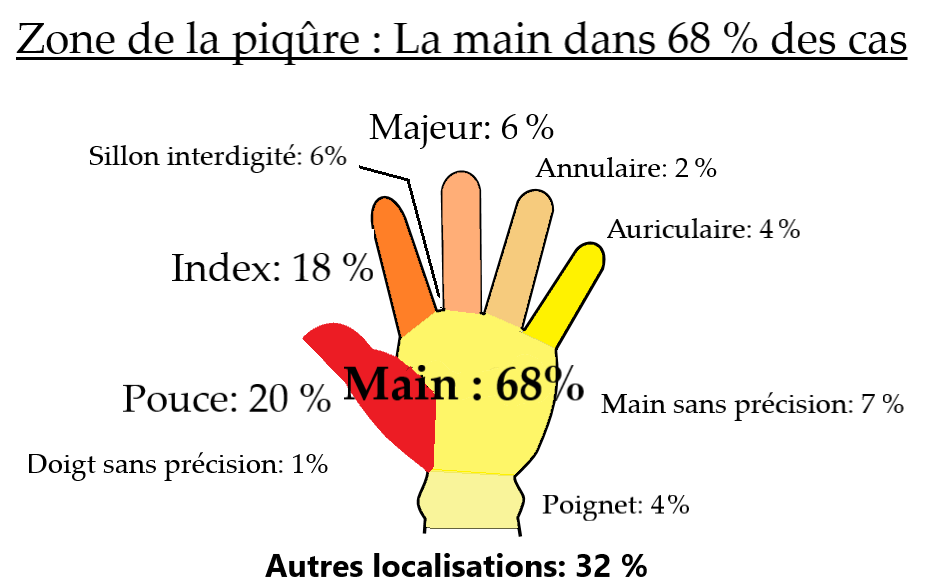 Graphique zone d'injection